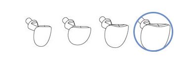 MULTIHOLDER CERVICAL MATRICES LG MOL /60