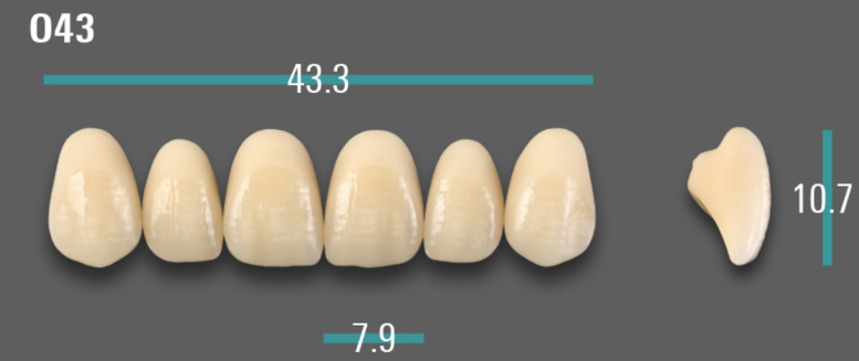 VITA VIONIC VIGO Anterior, 0M1, O43