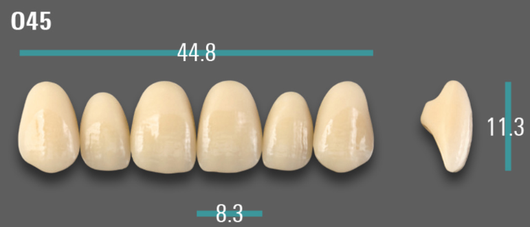 VITA VIONIC VIGO Anterior, 0M1, O45