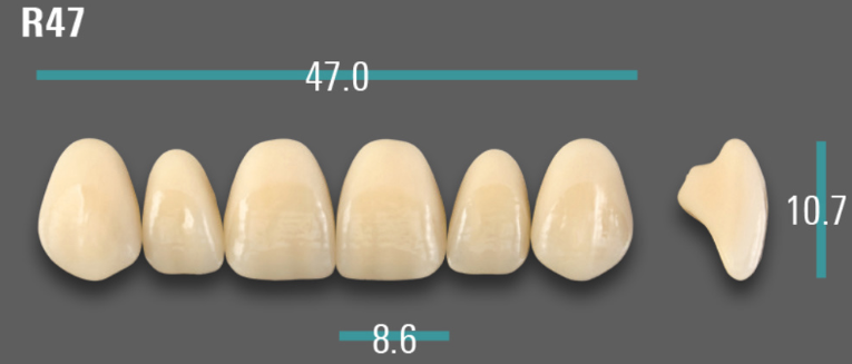 VITA VIONIC VIGO Anterior, 0M1, R47