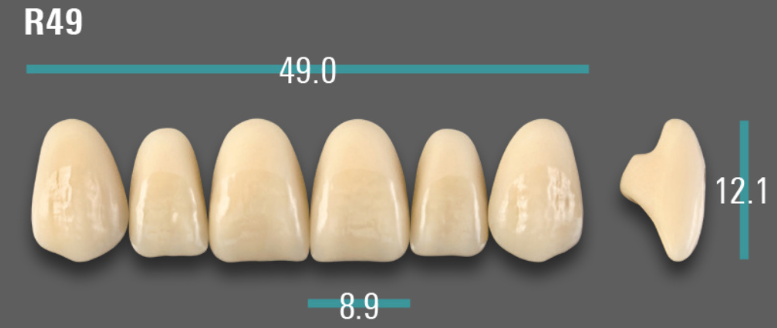 VITA VIONIC VIGO Anterior, 0M1, R49