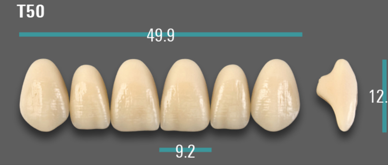 VITA VIONIC VIGO Anterior, 0M1, T50