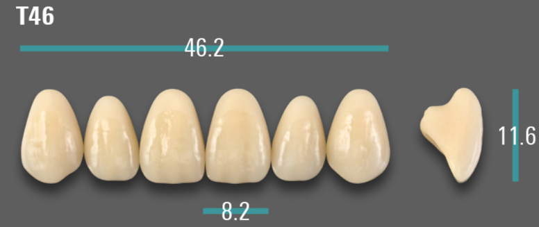 VITA VIONIC VIGO Anterior, A1, T46