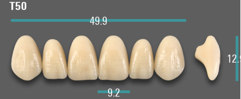VITA VIONIC VIGO Anterior, A1, T50