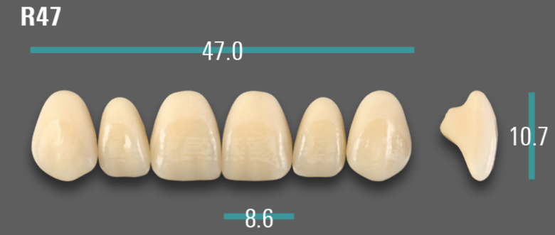 VITA VIONIC VIGO Anterior, A2, R47