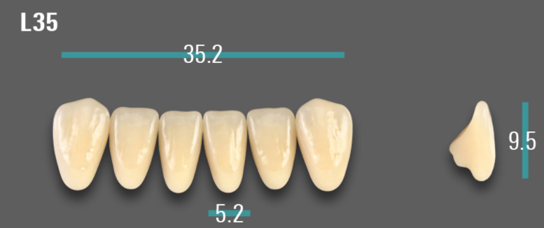 VITA VIONIC VIGO Anterior, A3.5, L35