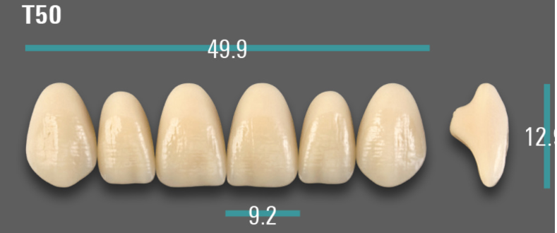 VITA VIONIC VIGO Anterior, A3.5, T50