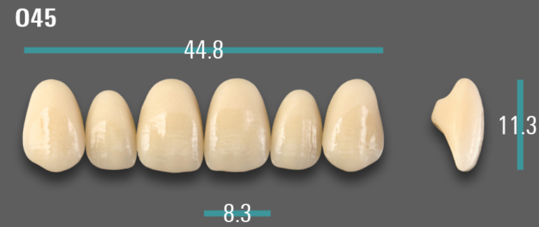 VITA VIONIC VIGO Anterior, A3, O45