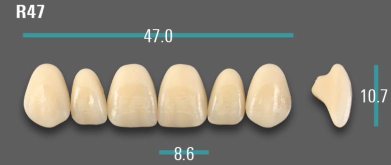 VITA VIONIC VIGO Anterior, A3, R47