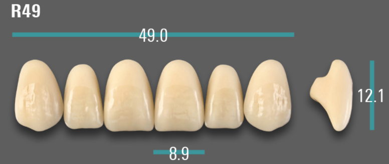 VITA VIONIC VIGO Anterior, A3, R49