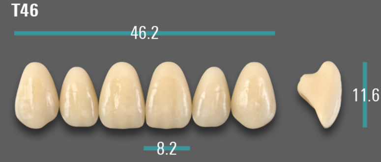 VITA VIONIC VIGO Anterior, A3, T46