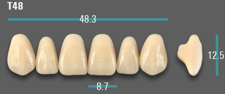 VITA VIONIC VIGO Anterior, A3, T48