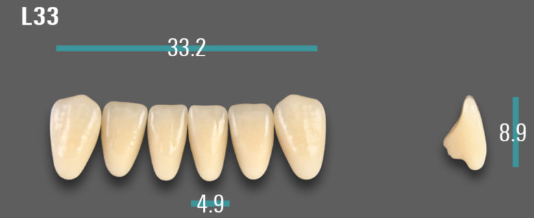 VITA VIONIC VIGO Anterior, B3, L33
