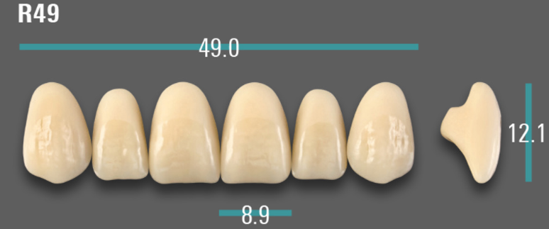 VITA VIONIC VIGO Anterior, B3, R49
