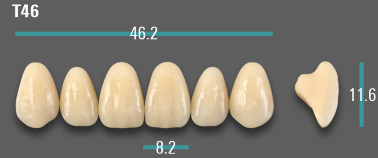 VITA VIONIC VIGO Anterior, B3, T46