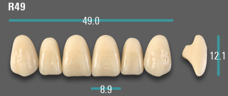 VITA VIONIC VIGO Anterior, D3, R49