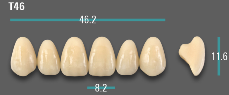 VITA VIONIC VIGO Anterior, D3, T46