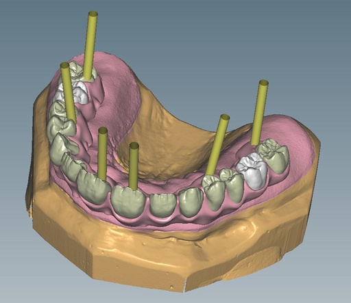 [AM179145] CERAMILL M-GIN MIND UPGRADE