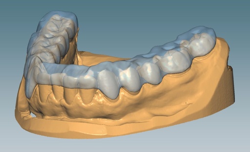 [AM179165] CERAMILL M SPLINT