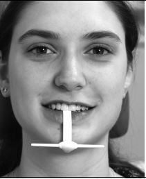 [AM504611] WOELFEL SLIDING GUIDE 4MM /10