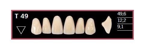[DLT49BL2] T49-BL2 DELARA TEETH UPPER ANTERIOR
