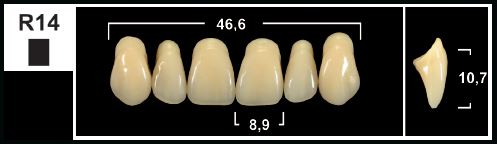 [GBR14-D2U] R14 D2 UPPER ANTERIOR TRIBOS TEETH