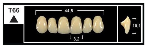 [GBT66-BL3] T66 BL3 UPPER ANTERIOR TRIBOS TEETH