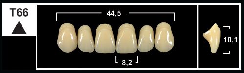 [GBT66-C3U] T66 C3 UPPER ANTERIOR TRIBOS TEETH