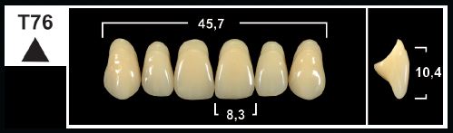 [GBT76-A1U] T76 A1 UPPER ANTERIOR TRIBOS TEETH