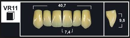 [GBVR11-B1U] VR11 B1 UPPER ANTERIOR TRIBOS TEETH