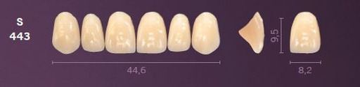[MOS443A2] S443-A2 MONDIAL TEETH UPPER ANTERIOR