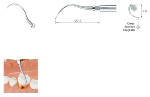 [NKZ291424] NSK ULTRASONIC PERIO TIP P25R-E FOR EMS