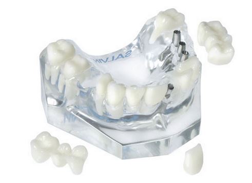 [SADEMOMODC7] DEMOMODEL 3 IMP/SINGLE & IMPL/NAT BRIDGE