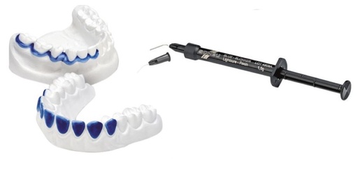 [SC5276] BLUE BLOKKER LIGHT CURING PUTTY 1.5G/4