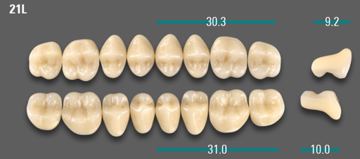 [VIAB0M1V21LUK] VITA VIONIC VIGO Posterior, 0M1, 21L UK