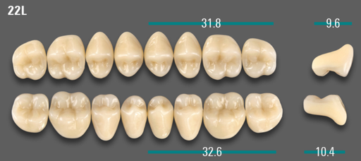 [VIAB0M1V22LOK] VITA VIONIC VIGO Posterior, 0M1, 22L OK