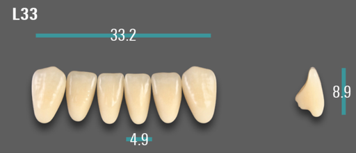[VIAB0M1VL33] VITA VIONIC VIGO Anterior, 0M1, L33