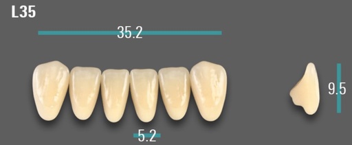[VIAB0M1VL35] VITA VIONIC VIGO Anterior, 0M1, L35