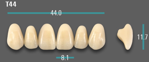 [VIAB0M1VT44] VITA VIONIC VIGO Anterior, 0M1, T44