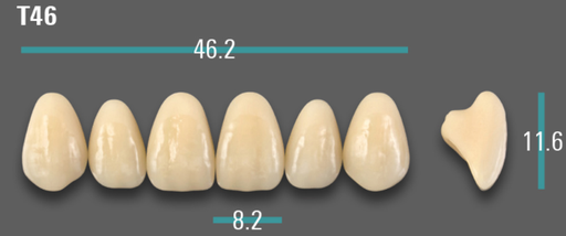 [VIAB0M1VT46] VITA VIONIC VIGO Anterior, 0M1, T46
