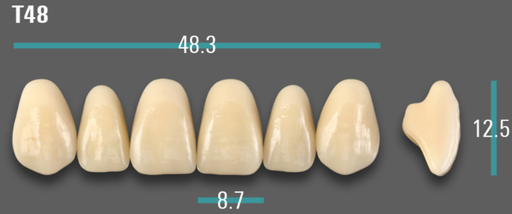 [VIAB0M1VT48] VITA VIONIC VIGO Anterior, 0M1, T48