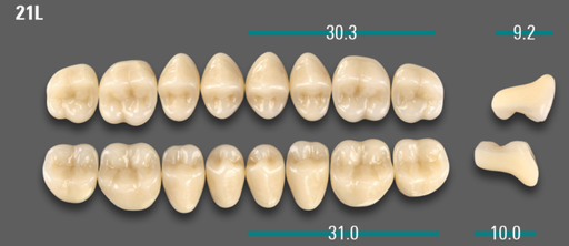 [VIABA1V21LOK] VITA VIONIC VIGO Posterior, A1, 21L OK