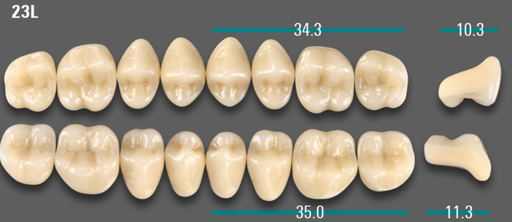 [VIABA1V23LUK] VITA VIONIC VIGO Posterior, A1, 23L UK