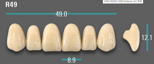 [VIABA1VR49] VITA VIONIC VIGO Anterior, A1, R49