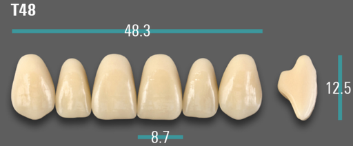 [VIABA1VT48] VITA VIONIC VIGO Anterior, A1, T48