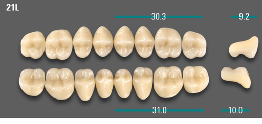 [VIABA2V21LUK] VITA VIONIC VIGO Posterior, A2, 21L UK