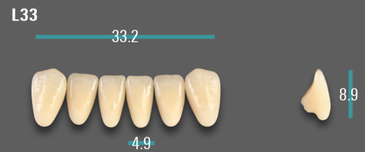 [VIABA2VL33] VITA VIONIC VIGO Anterior, A2, L33