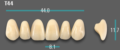 [VIABA2VT44] VITA VIONIC VIGO Anterior, A2, T44