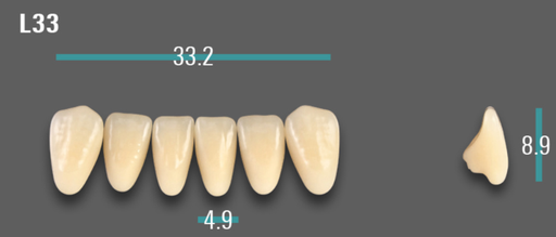 [VIABA35VL33] VITA VIONIC VIGO Anterior, A3.5, L33