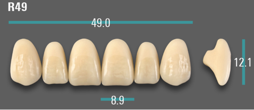 [VIABA35VR49] VITA VIONIC VIGO Anterior, A3.5, R49